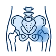 Hip Pain Treatment