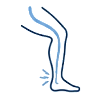 Sciatica Treatment